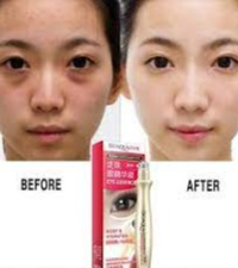 Eye Bag Removal Esence Serum Anti Wrinkle Remove Dark Circles & Fine Lines Eye Ball Roller kn-445